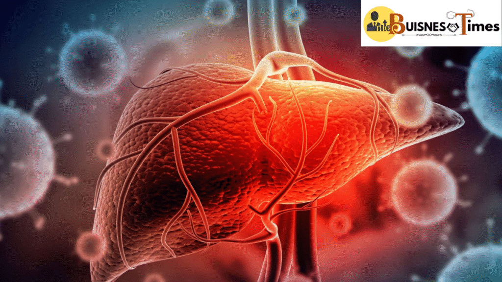 Hepatitis