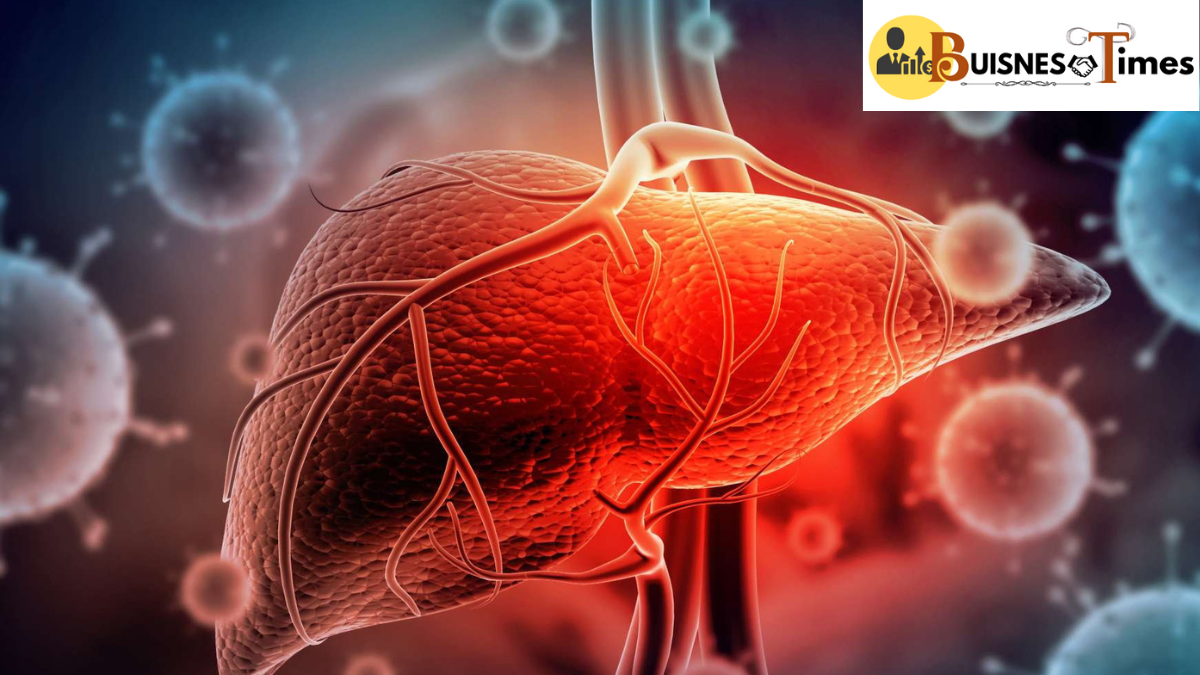 Hepatitis